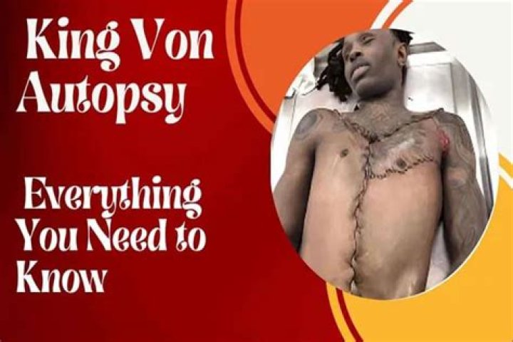 King Von Autopsy: A Deep Dive into the Life and Legacy of a Hip-Hop Icon